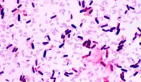 Bacillus Pumilus
