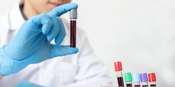 Blood Test