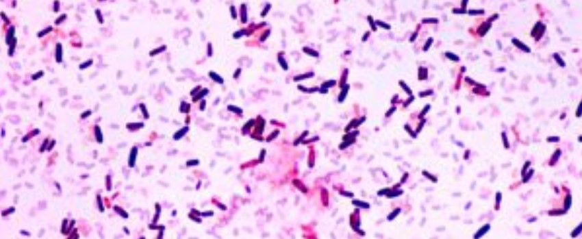 Bacillus Pumilus
