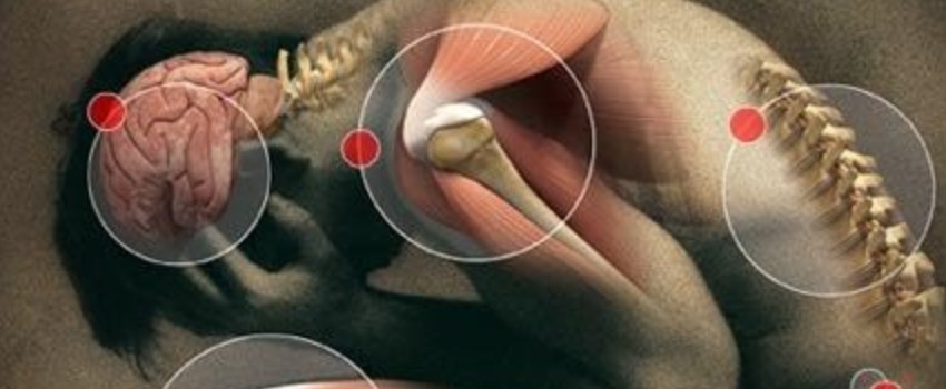 Strains for Generalized Pain