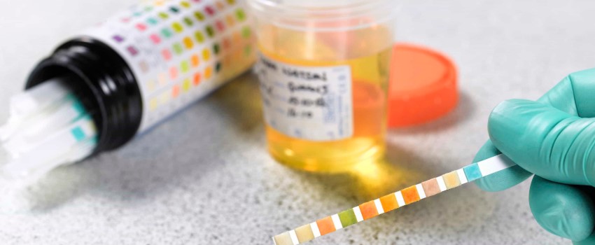 Taking A Drug Test While Smoking Weed